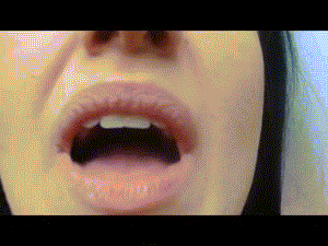 43779 - pleghm on throat, big tonsils, tongue and teeth