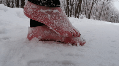 84616 - Frostbitten Feet