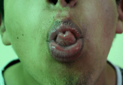 102570 - Delicious Tongue