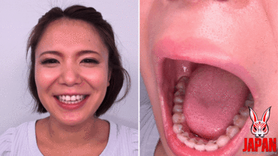 176815 - Teeth Examination: Beauty Unveiled