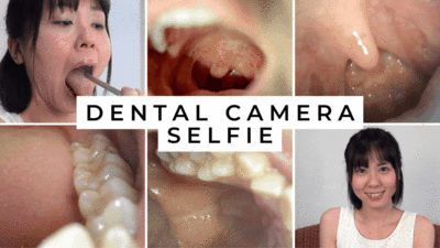 177072 - Dental camera Selfie, Marika NARUSE