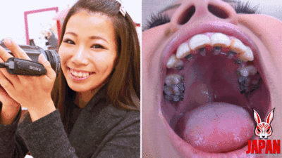 177111 - Orthodontic Teeth Fetish : Izumi Asato's Dental Fantasy