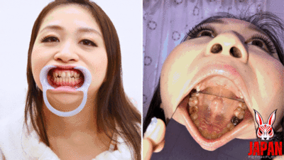 177336 - Dental Exploration: Rin Suzumiya's Oral Adventure