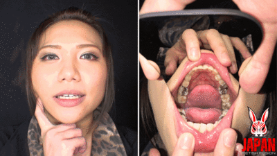 177396 - Teeth Obsession Unleashed: The Sensational Video Starring Reina Kitamura