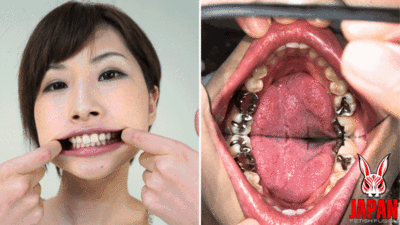 177809 - Teeth Inspection Chronicles: Dive into Yua Hidaka's Enigmatic Oral Realm