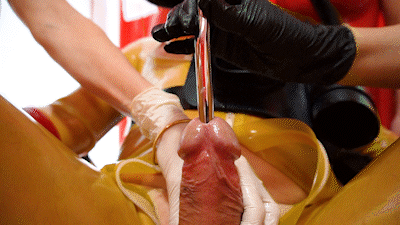 171667 - Urethral examination (SD Video)
