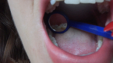 84455 - Mouth Tour with Dental Mirror